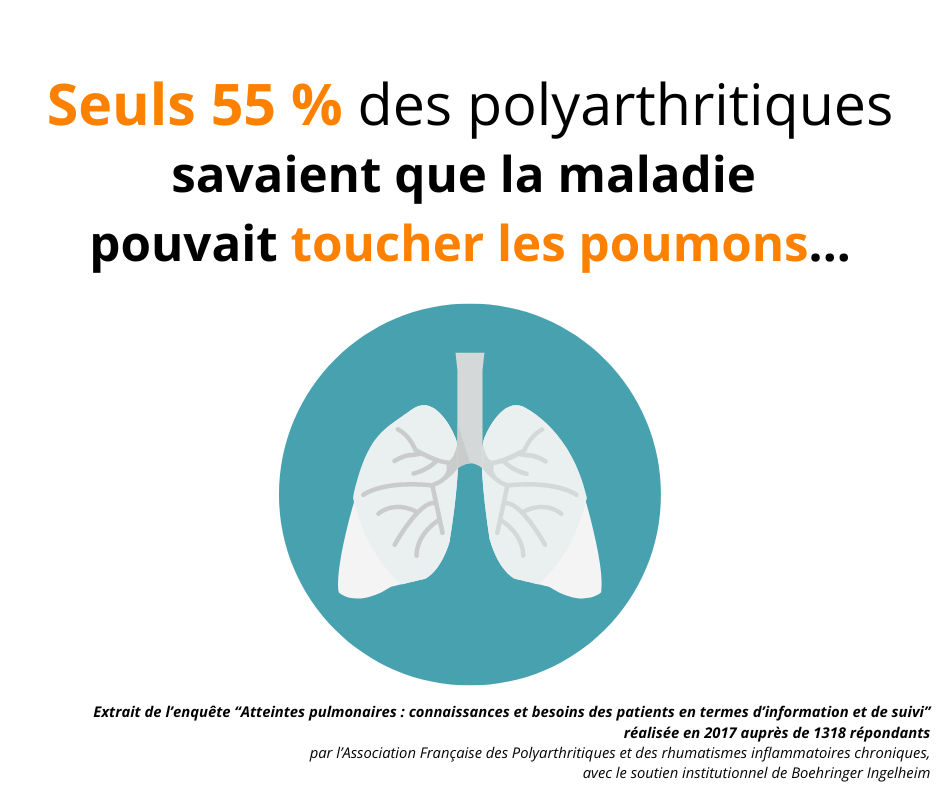 Seuls 55 % des polyarthritiques savaient que la maladie pouvait toucher les poumons