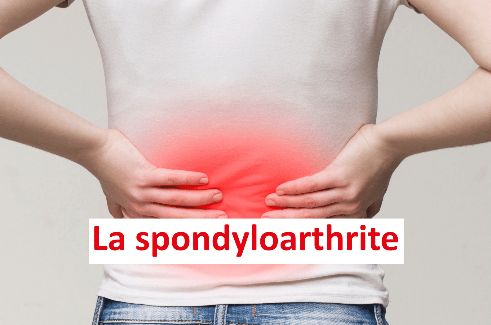 Image cliquable pour en savoir plus sur la spondyloarthrite